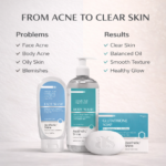 Clear Skin Routine Combo - Image 5